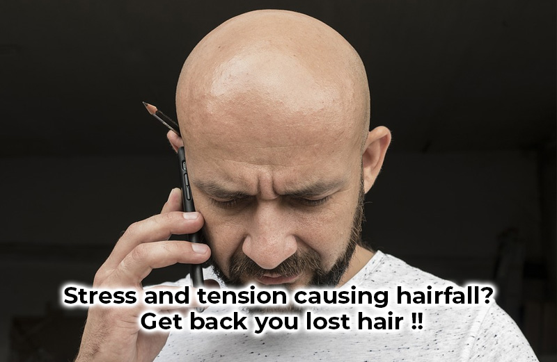 Stress and tension causing hairfall?  Get back you lost hair !!